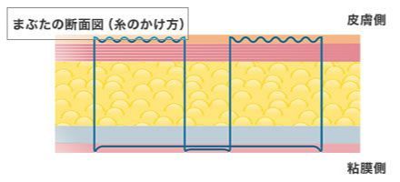 画像:複雑な二重の手術(2)