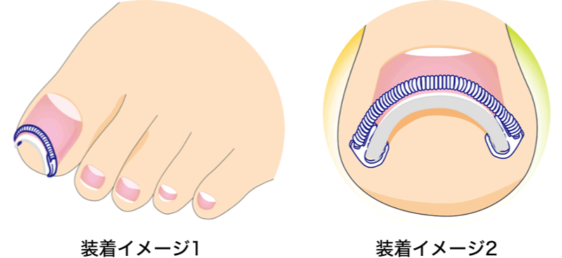 画像:装着イメージ
