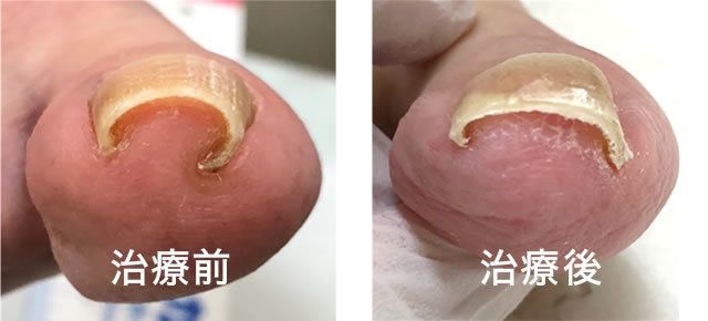 画像:治療前・治療後